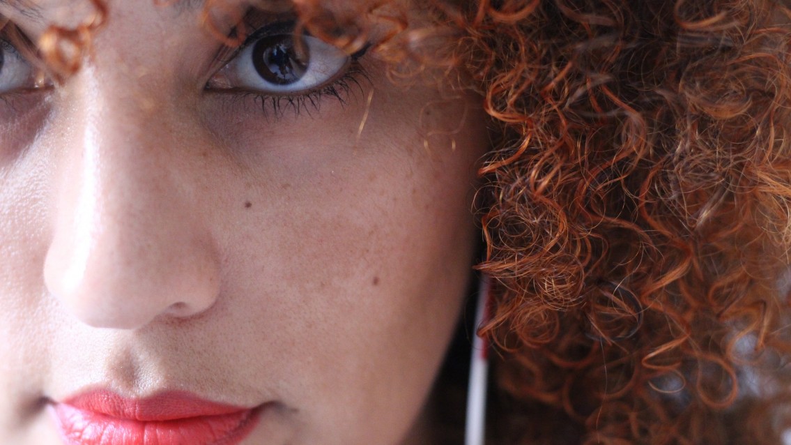 Melasma não é somente uma doença de pele como pensam Melasma não é somente uma doença de pele como pensam